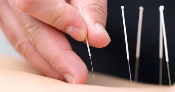 Akunpunktur İle İnfertilite Tedavisi