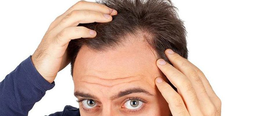 Saç Ekimi İçin Uygun Yaş Aralığı Nedir?